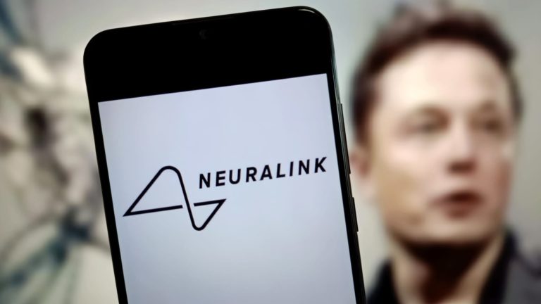 Neuralink od Elona Muska po prvý raz implantuje mozgovú technológiu u ľudského pacienta