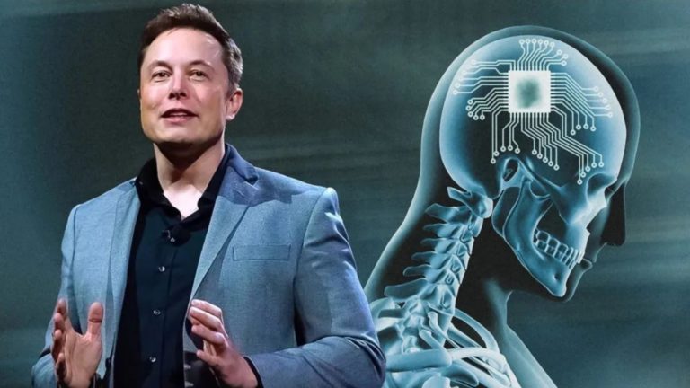 Elon Musk povedal, že osoba s mozgovým čipom sa úplne zotavila