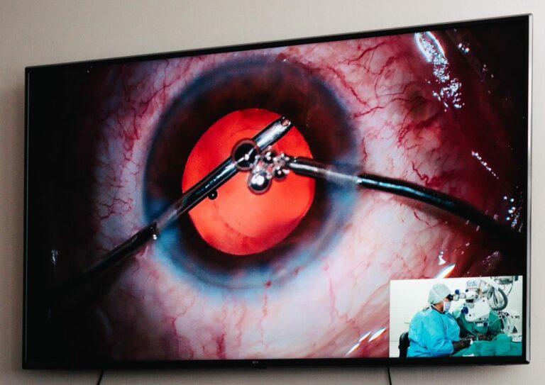 Odborníci z Univerzitnej nemocnice Bratislava dokážu prinavrátiť zrak pacientom pomocou unikátnej operácie (foto)